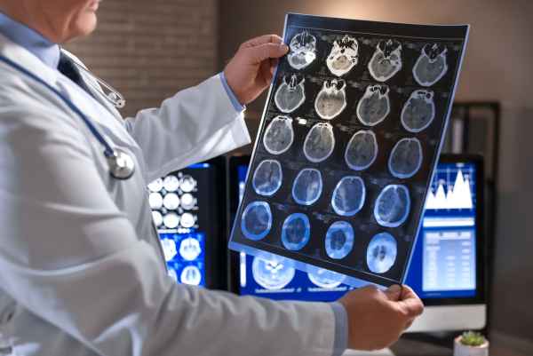 Consulta com Neurologista